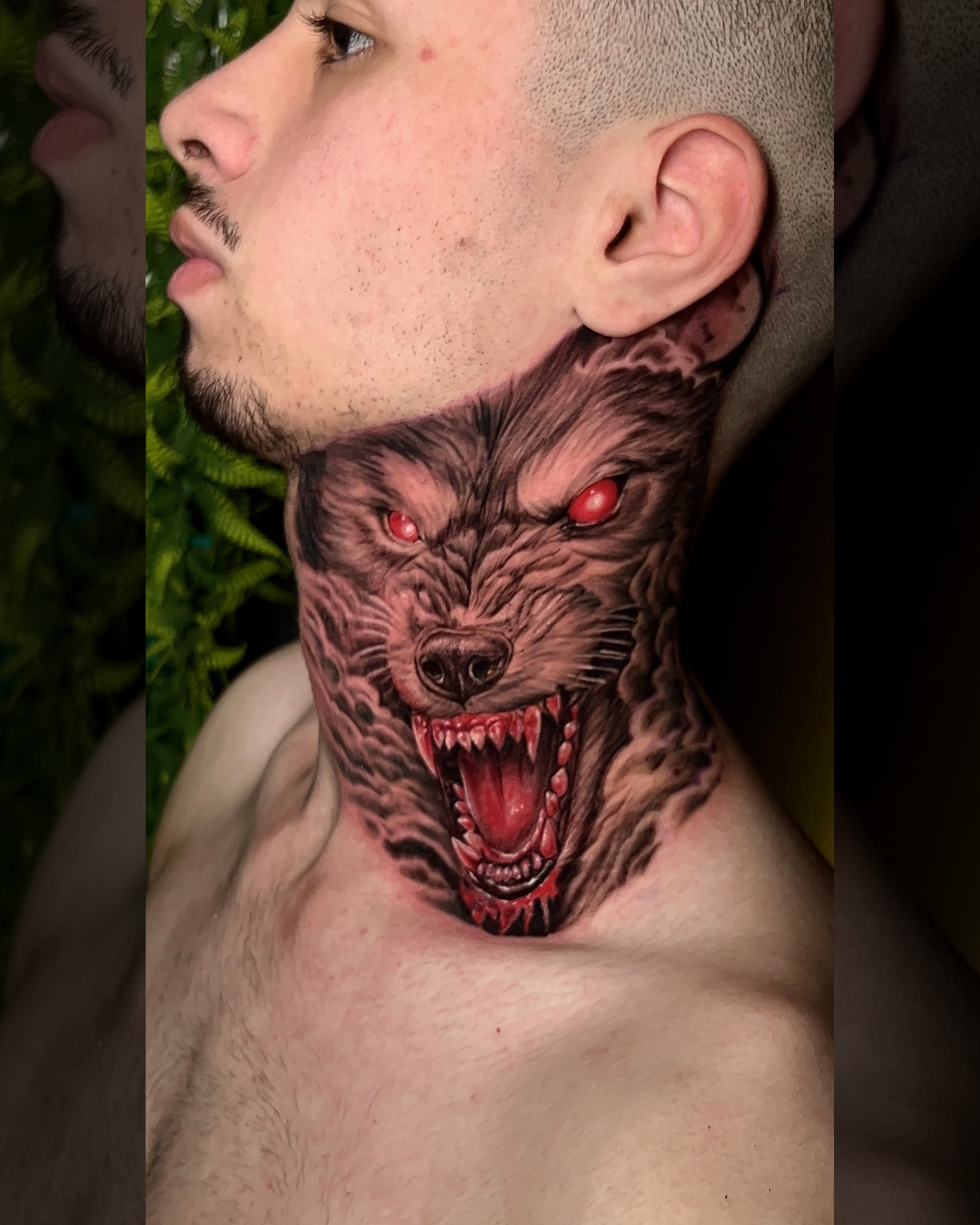 lobo no pescoço